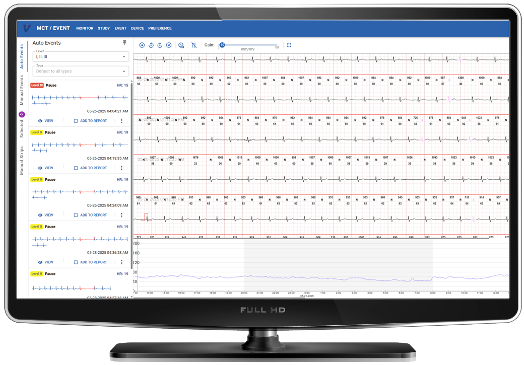 monitor-w-mct monitor-w-mct